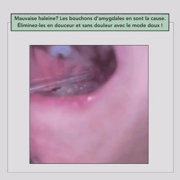 hydropulseur